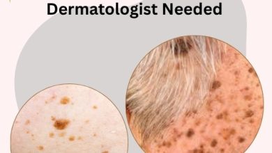How to Get Rid of Seborrheic Keratosis Fast