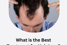 What is the Best Treatment for Hair Loss