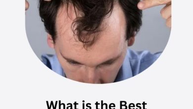What is the Best Treatment for Hair Loss
