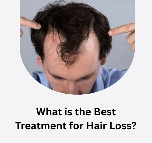 What is the Best Treatment for Hair Loss