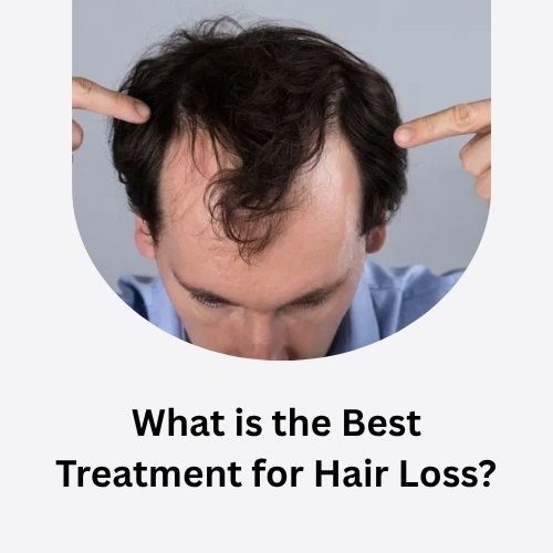 What is the Best Treatment for Hair Loss