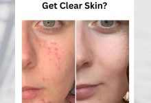 What is the Best Way to Get Clear Skin