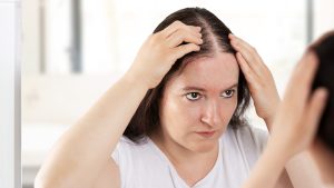 Best-Hair-Loss-Treatments-for-Men