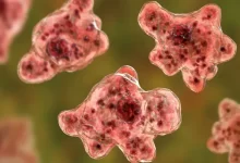 Brain-Eating Amoeba Kills Patient in South Carolina