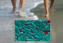 Flesh Eating Bacteria in New Jersey