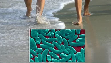 Flesh Eating Bacteria in New Jersey