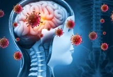 Shocking Brain Aging Effects of COVID-19