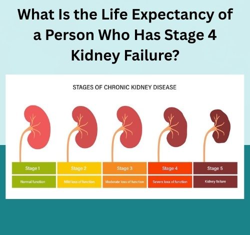 What Is the Life Expectancy of a Person Who Has Stage 4 Kidney Failure