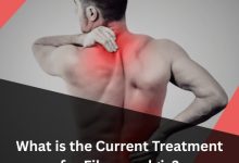 What is the Current Treatment for Fibromyalgia