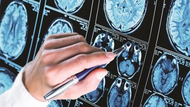 Is Lithium Orotate the Ultimate Brain Supplement of 2025
