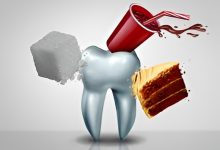 5 Popular Foods That Damage Your Teeth More Than Sugar