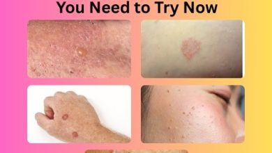 5 Powerful Herbal Supplements for Skin Healing You Need to Try Now