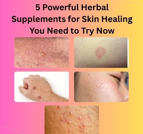 5 Powerful Herbal Supplements for Skin Healing You Need to Try Now