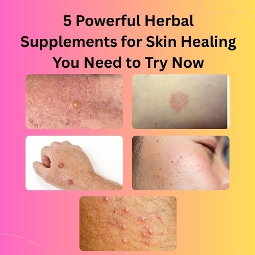 5 Powerful Herbal Supplements for Skin Healing You Need to Try Now