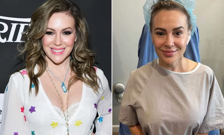 Alyssa Milano’s Brave Decision to Remove Her Breast Implants