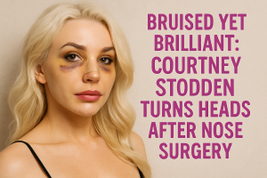 Bruised Yet Brilliant: Courtney Stodden Turns Heads After Nose Surgery