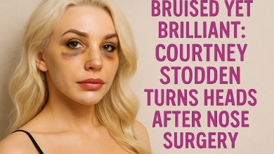 Bruised Yet Brilliant: Courtney Stodden Turns Heads After Nose Surgery