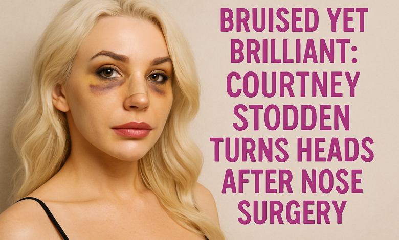 Bruised Yet Brilliant: Courtney Stodden Turns Heads After Nose Surgery