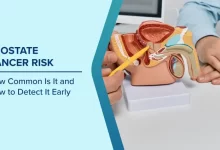 How to Lower Your Prostate Cancer Risk: Doctors Reveal 7 Proven Habits