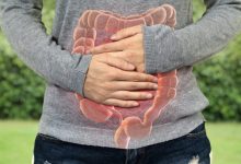 Natural Ways to Improve Digestive Health After Surgery
