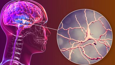 Parkinson’s Breakthrough