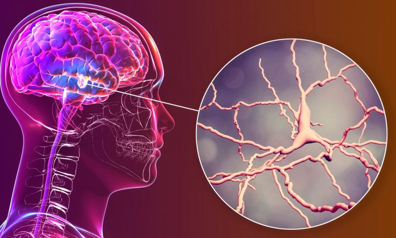 Parkinson’s Breakthrough
