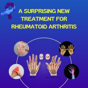 Treatment for Rheumatoid Arthritis