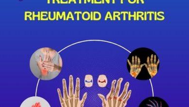 Treatment for Rheumatoid Arthritis