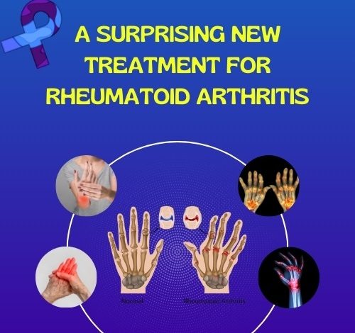 Treatment for Rheumatoid Arthritis