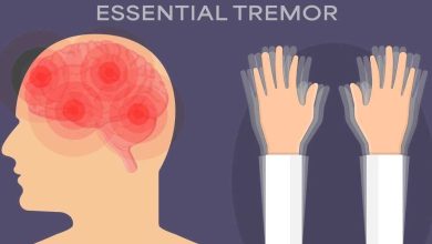 Benign-Essential-Tremor-780x470