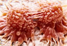 Breakthrough Light Therapy Kills Cancer Cells in Just 30 Minutes