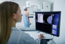 Breast Cancer Survival