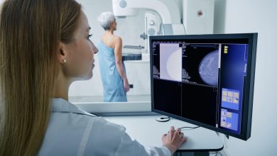 Breast Cancer Survival