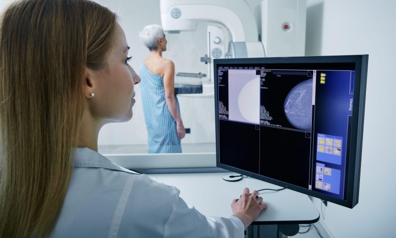 Breast Cancer Survival