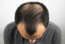 From Sweetener to Scalp Savior Stevia’s Surprising Hair Growth Secret Revealed!