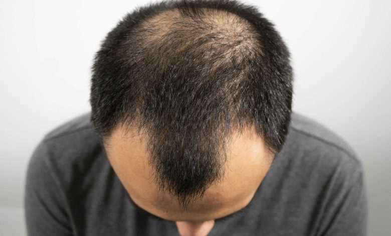 From Sweetener to Scalp Savior Stevia’s Surprising Hair Growth Secret Revealed!