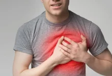 Heart Attack