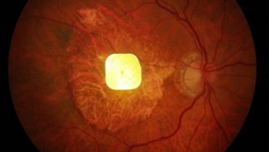 Revolutionary Prosthetic Eye Chip Restores Sight