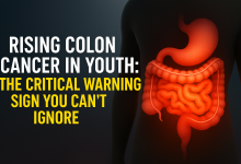 Rising Colon Cancer in Youth: The Critical Warning Sign You Can’t Ignore