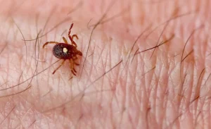 First Meat Allergy Death Linked to Tick Bite Raises Public Health Warnings