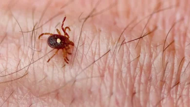 First Meat Allergy Death Linked to Tick Bite Raises Public Health Warnings