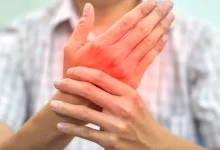 Herbal Solutions for Rheumatoid Arthritis 1