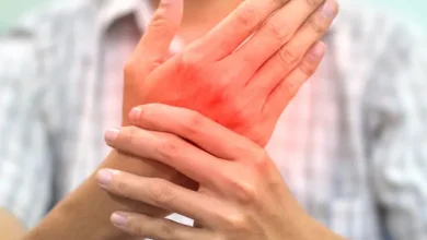 Herbal Solutions for Rheumatoid Arthritis 1
