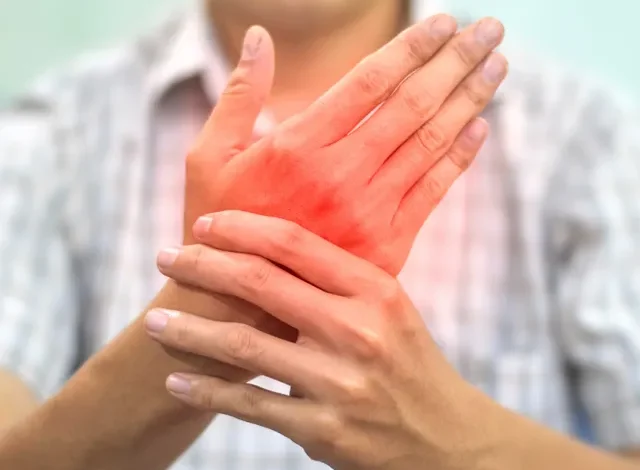Herbal Solutions for Rheumatoid Arthritis 1