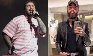 Post Malone’s Weight Loss Journey