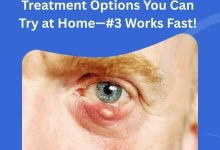 Top Sebaceous Cyst Eyelid Treatment