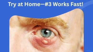 Top Sebaceous Cyst Eyelid Treatment