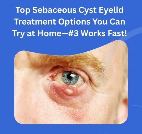 Top Sebaceous Cyst Eyelid Treatment