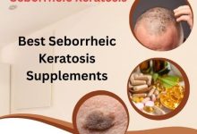Best Seborrheic Keratosis Supplements