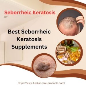 Best Seborrheic Keratosis Supplements